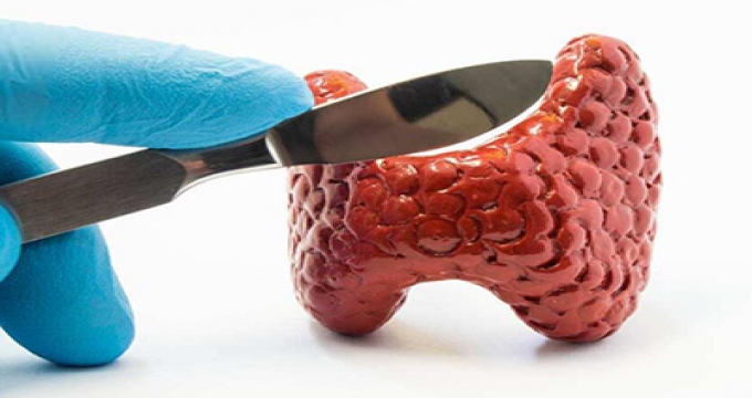 患甲状腺结节，多吃海带好还是少吃海带好？